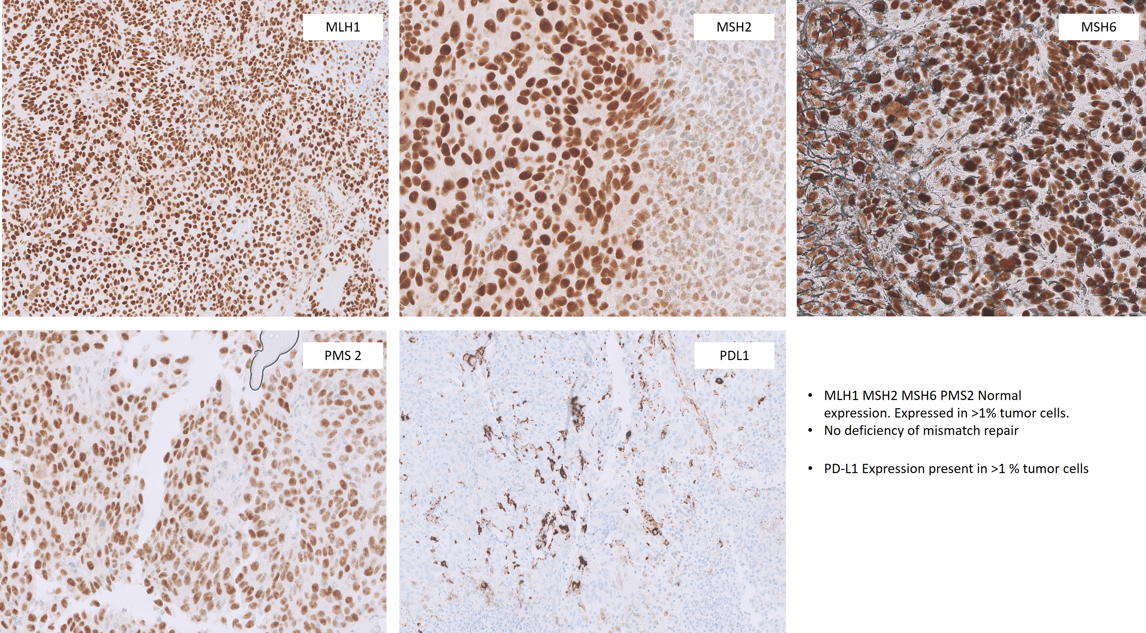 Microscopic image possibly detecting cancerous areas in human tissue