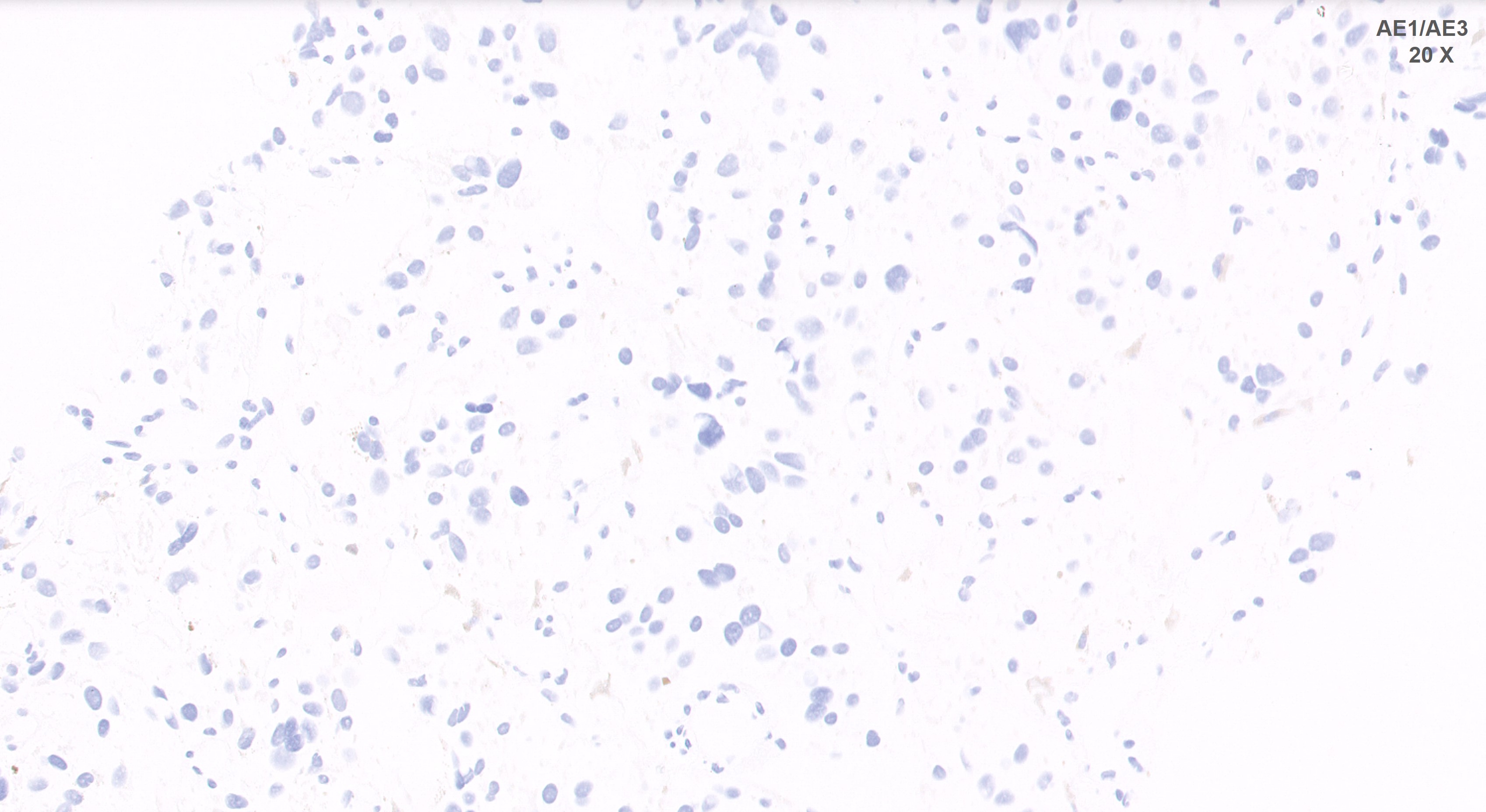 Microscopic image possibly detecting cancerous areas in human tissue