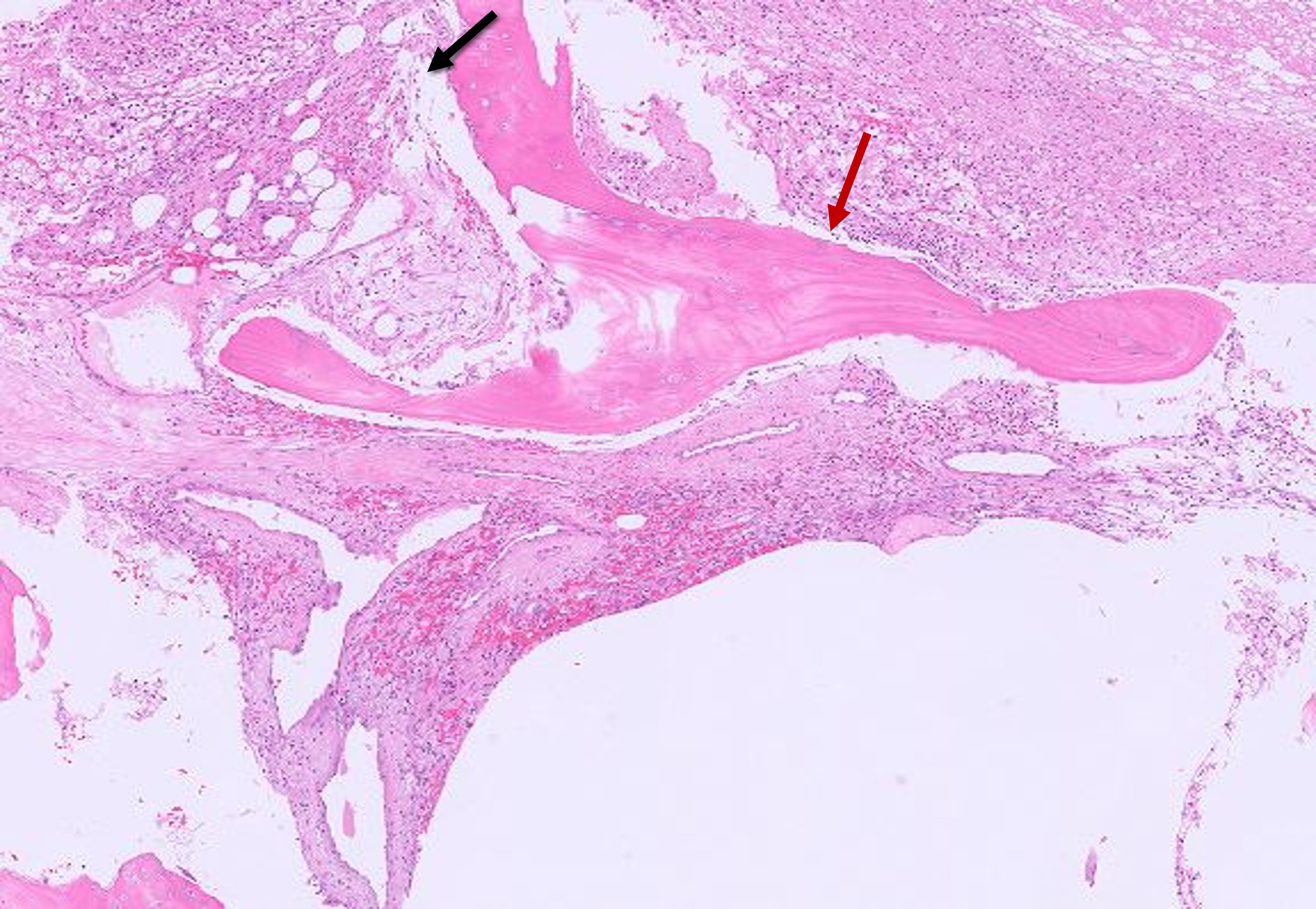 Microscopic image possibly detecting cancerous areas in human tissue