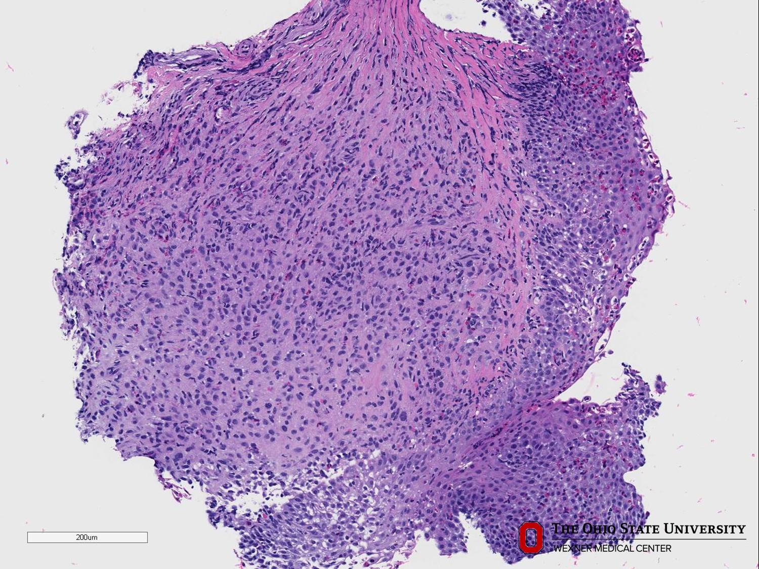 Microscopic image possibly detecting cancerous areas in human tissue