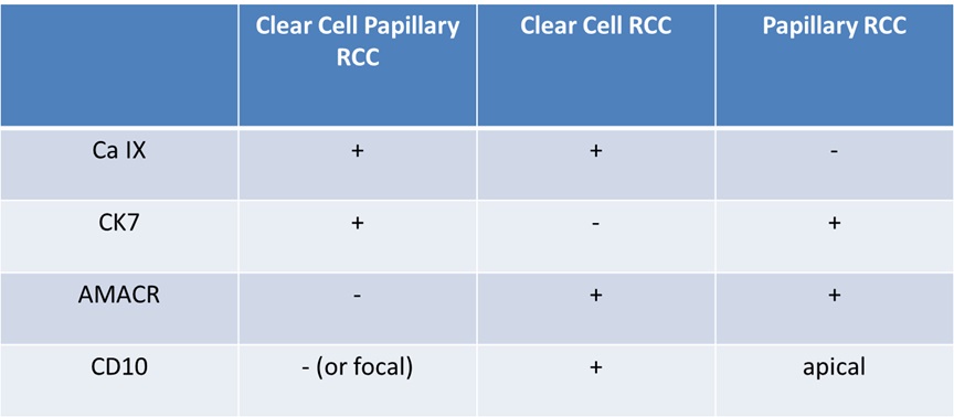 Tubulopapillary carcinoma table