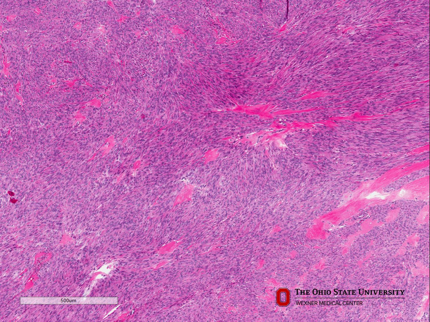 Microscopic image possibly detecting cancerous areas in human tissue