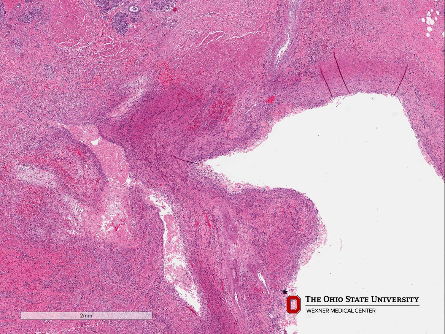 Microscopic image possibly detecting cancerous areas in human tissue