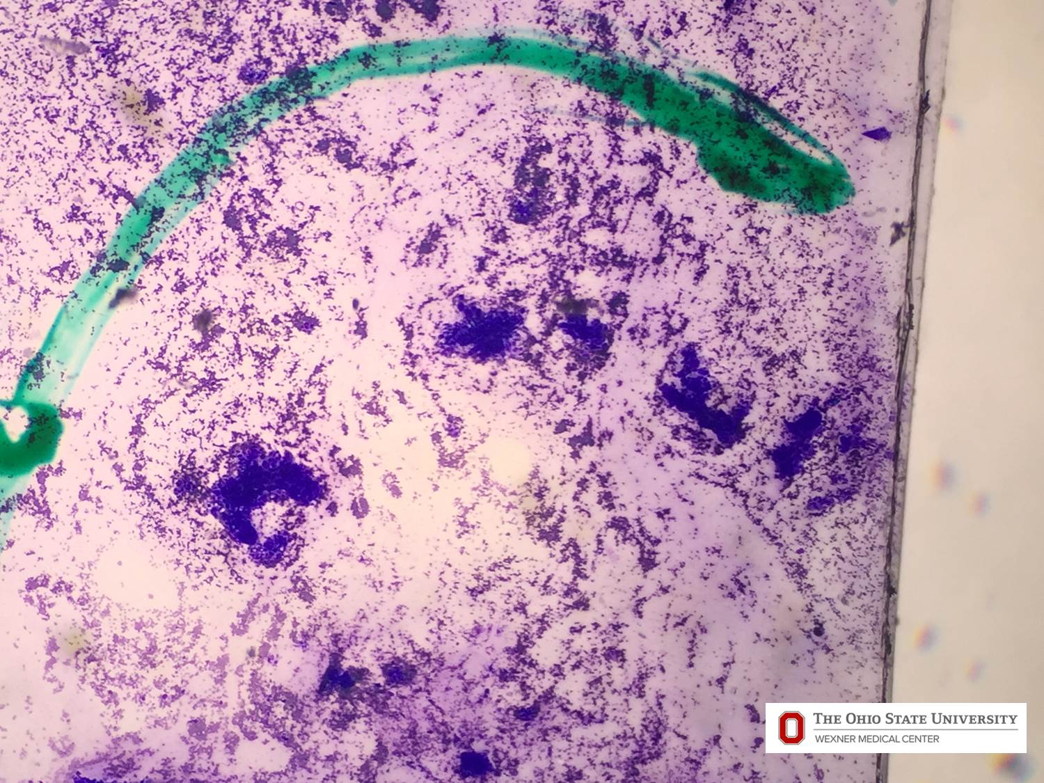 Microscopic image possibly detecting cancerous areas in human tissue