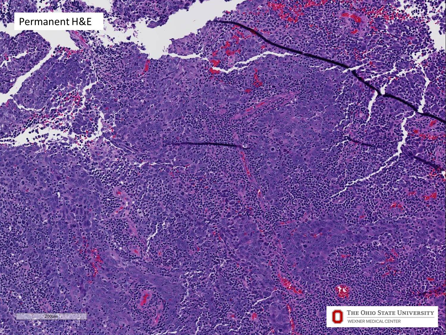 Microscopic image possibly detecting cancerous areas in human tissue