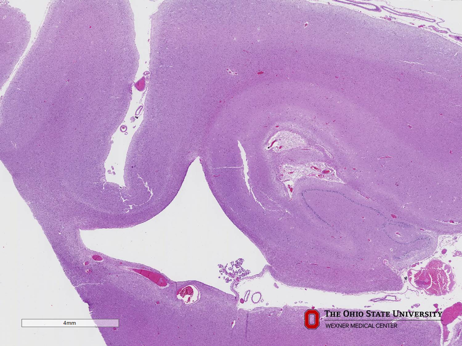 Microscopic image possibly detecting cancerous areas in human tissue