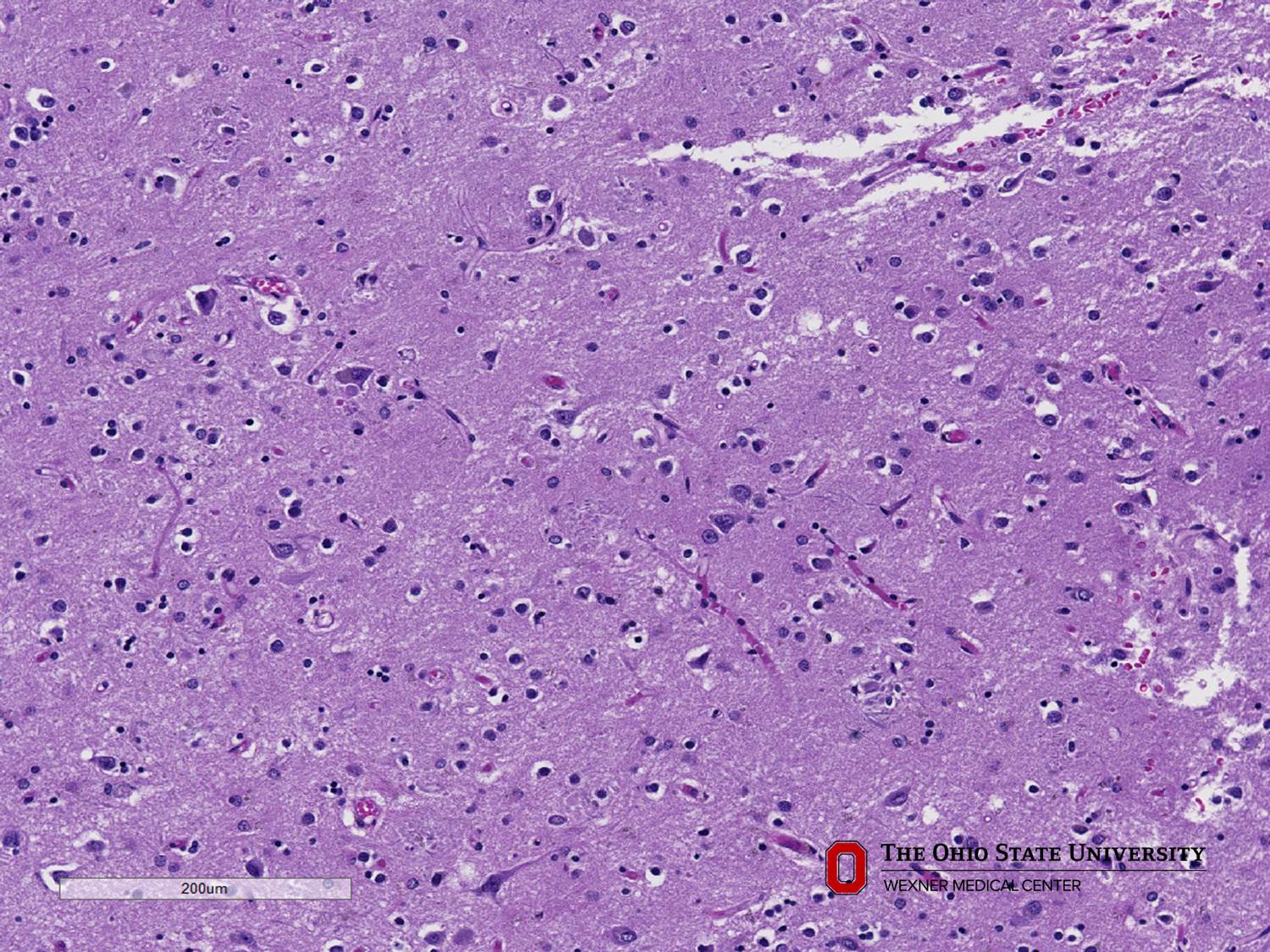 Microscopic image possibly detecting cancerous areas in human tissue