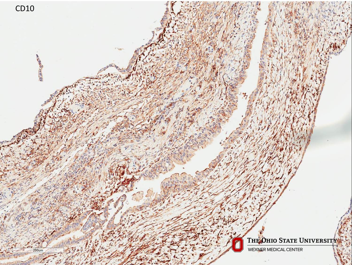 Microscopic image possibly detecting cancerous areas in human tissue