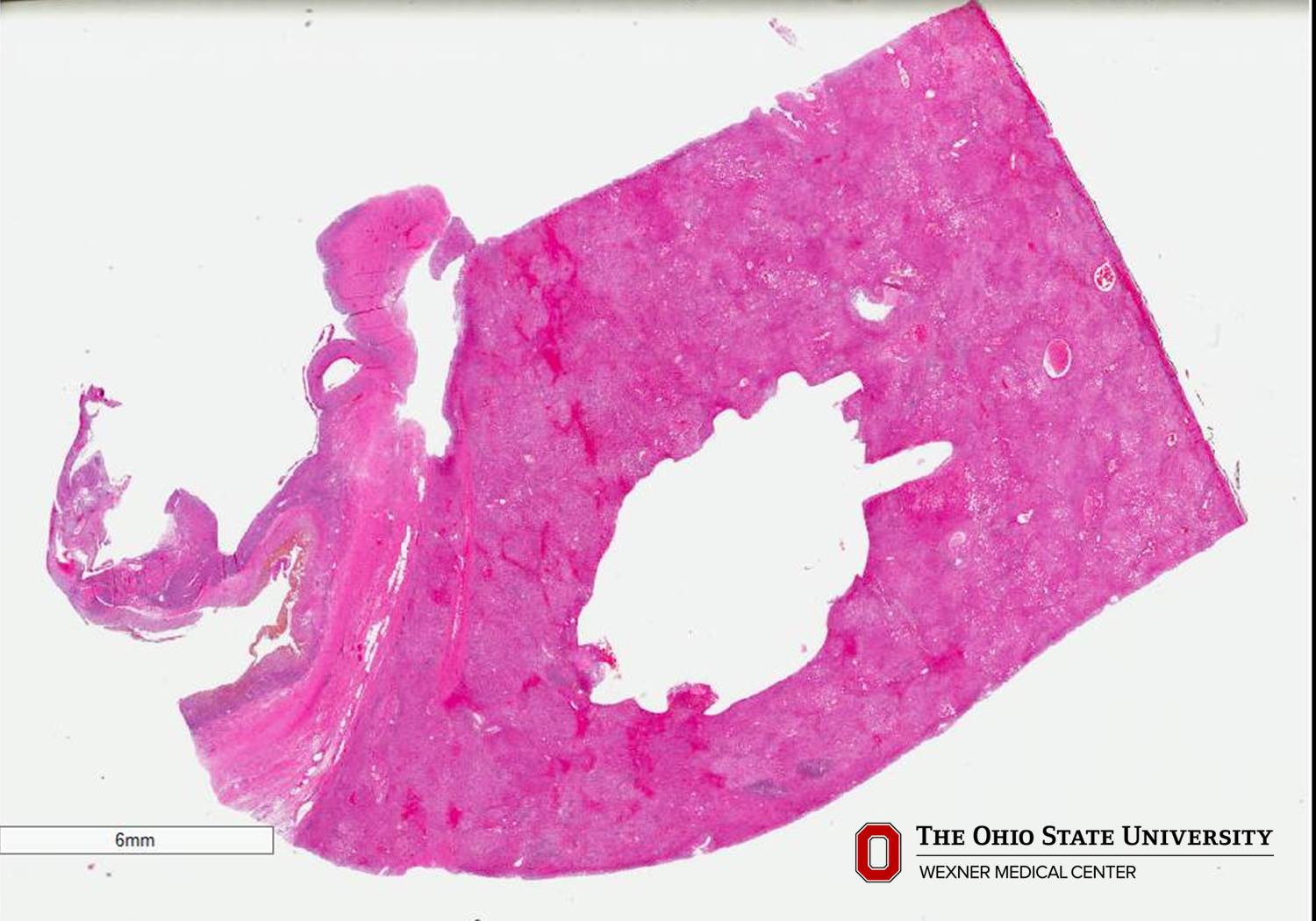 Microscopic image possibly detecting cancerous areas in human tissue