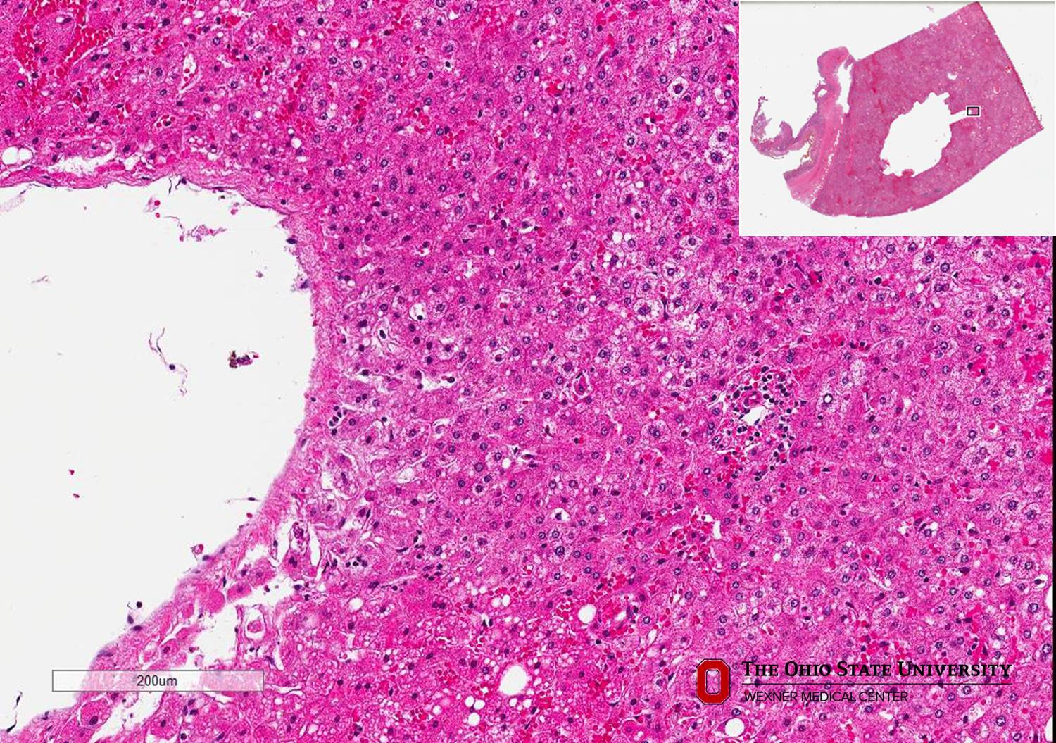 Microscopic image possibly detecting cancerous areas in human tissue