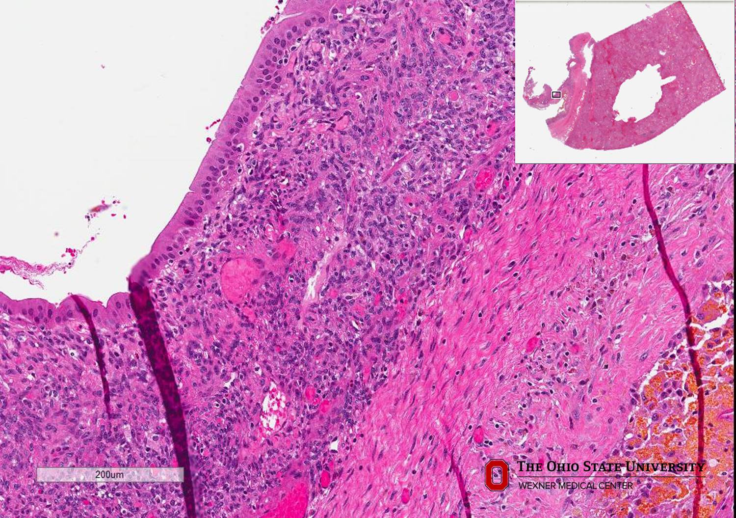 Microscopic image possibly detecting cancerous areas in human tissue