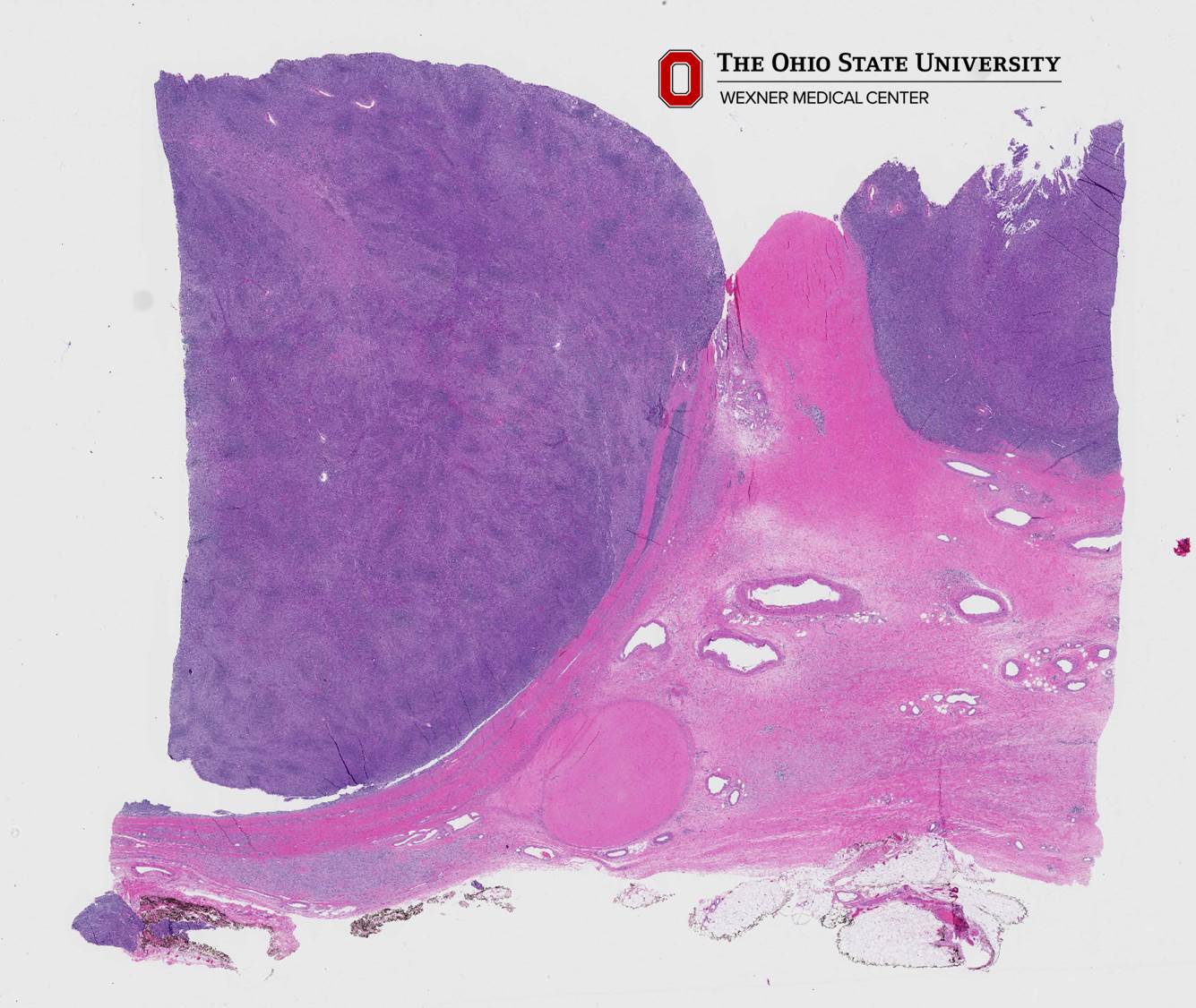 Microscopic image possibly detecting cancerous areas in human tissue