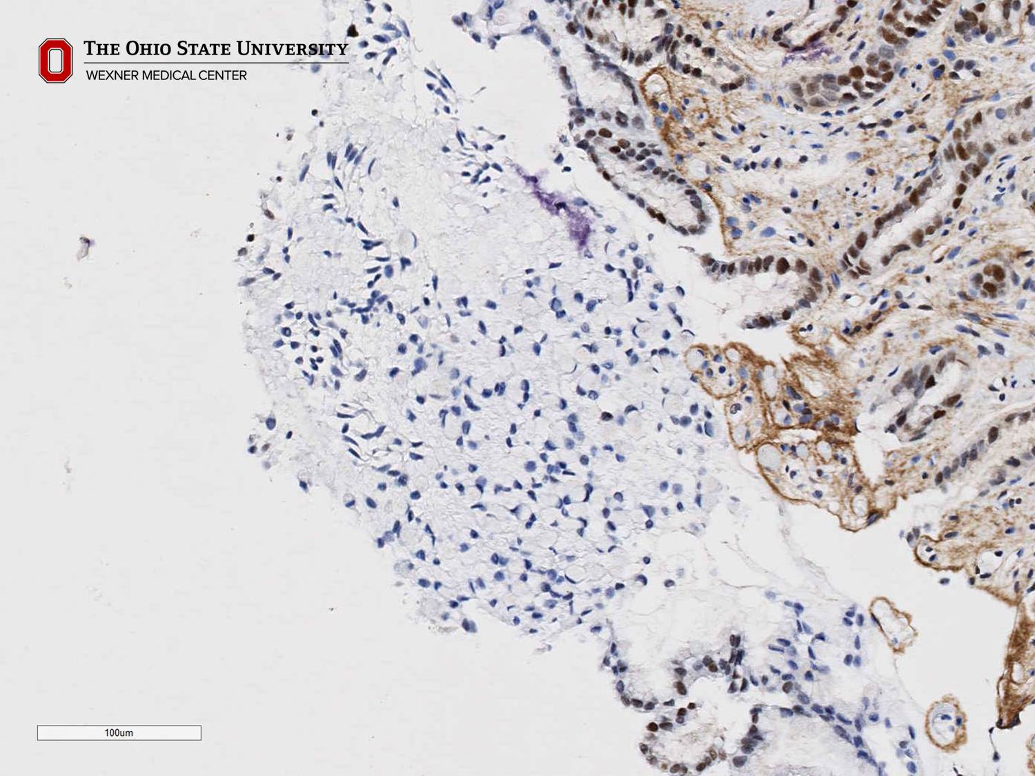 Microscopic image possibly detecting cancerous areas in human tissue