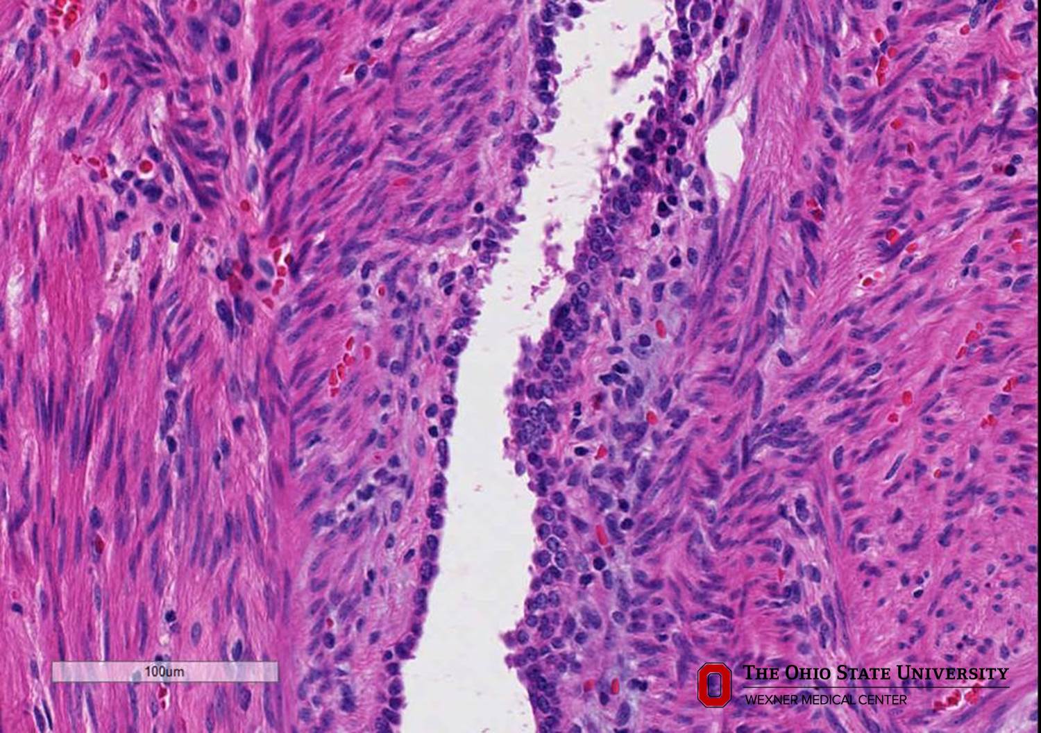 Microscopic image possibly detecting cancerous areas in human tissue