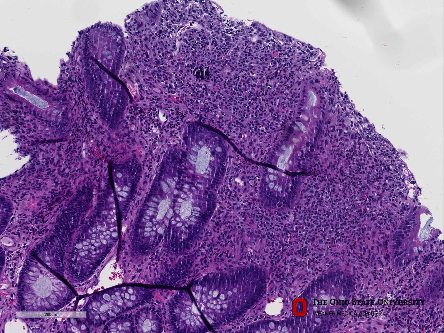 Microscopic image possibly detecting cancerous areas in human tissue