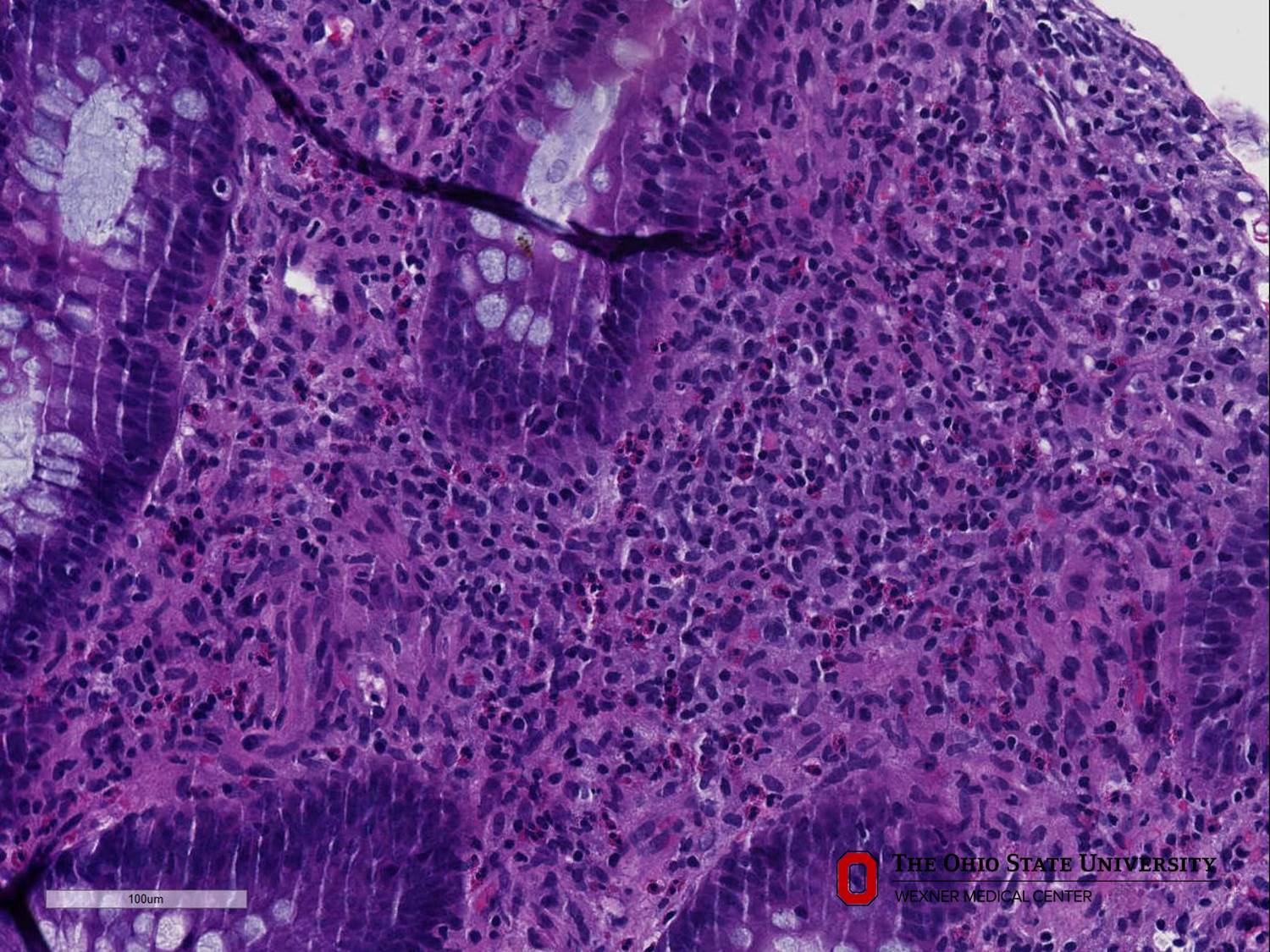 Microscopic image possibly detecting cancerous areas in human tissue