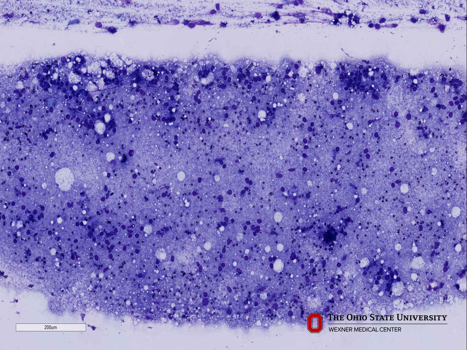 Microscopic image possibly detecting cancerous areas in human tissue