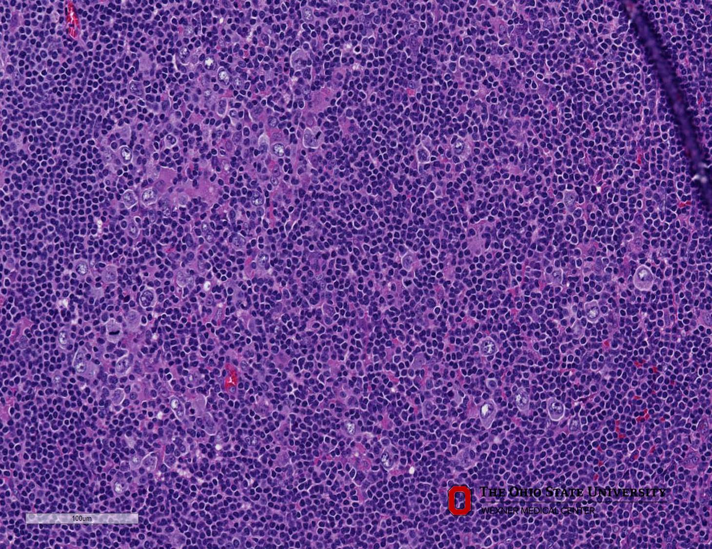 Microscopic image possibly detecting cancerous areas in human tissue