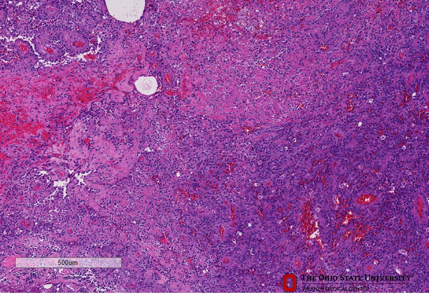 Microscopic image possibly detecting cancerous areas in human tissue