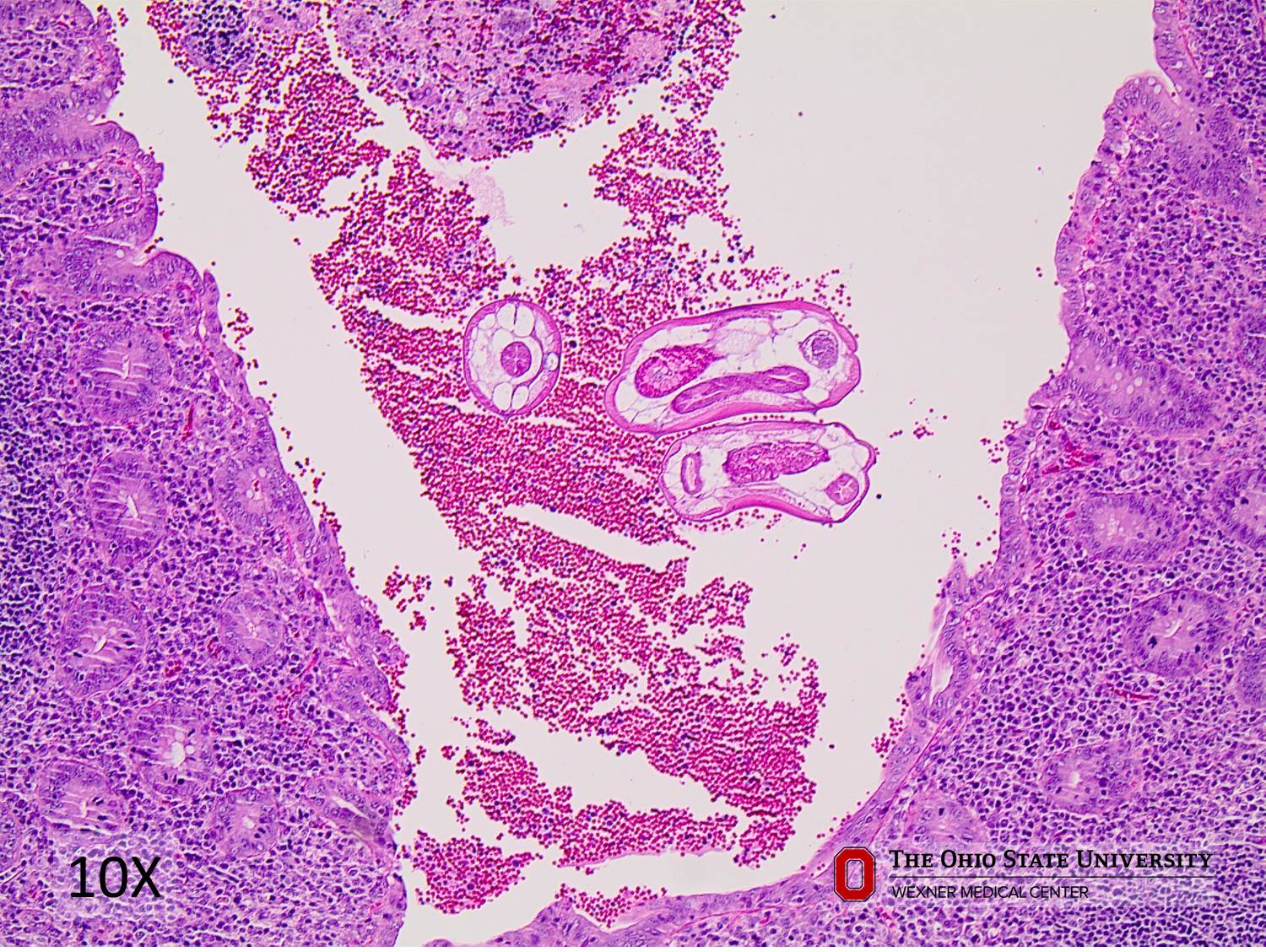 Microscopic image possibly detecting cancerous areas in human tissue