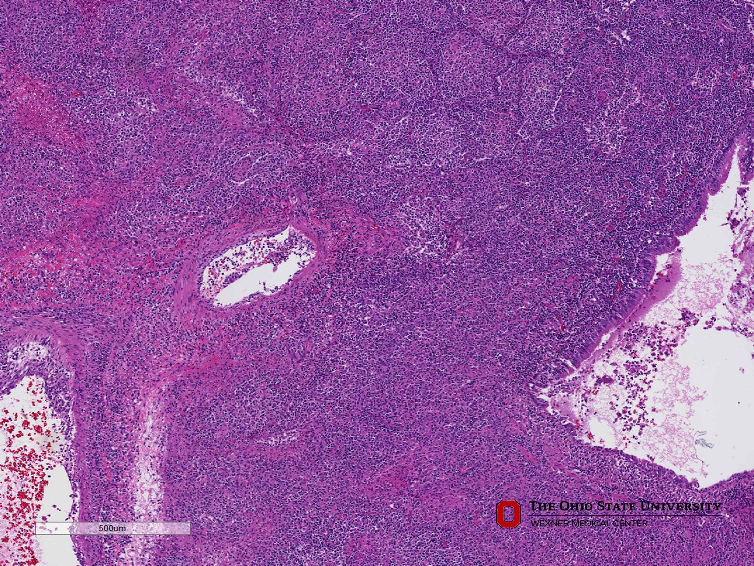 Microscopic image possibly detecting cancerous areas in human tissue