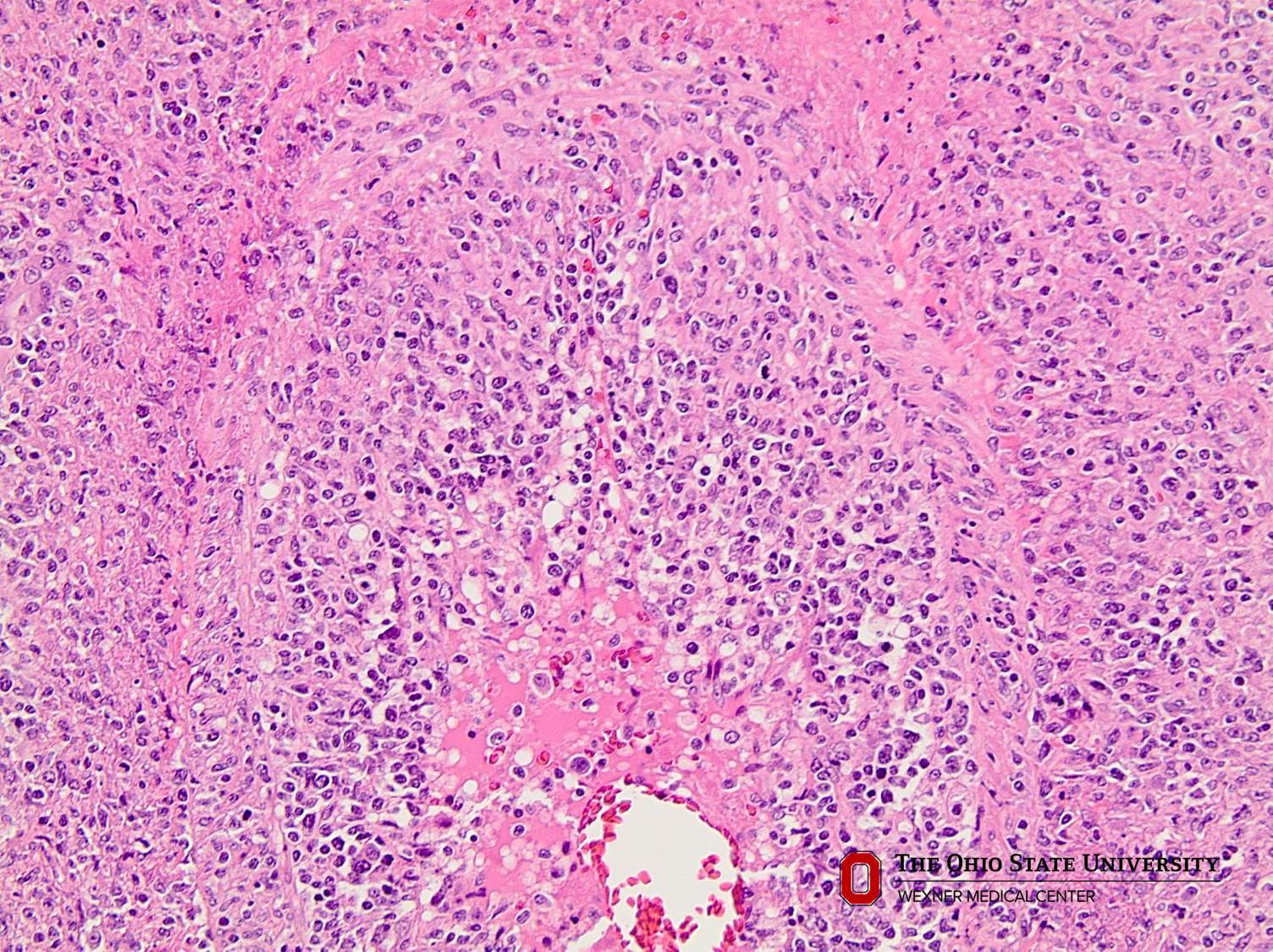 Microscopic image possibly detecting cancerous areas in human tissue