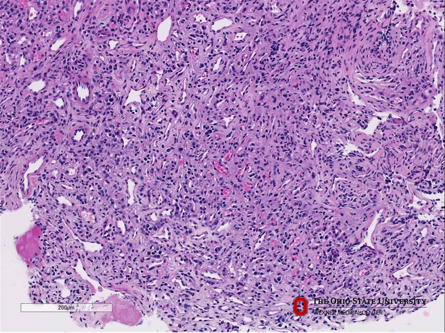 Microscopic image possibly detecting cancerous areas in human tissue