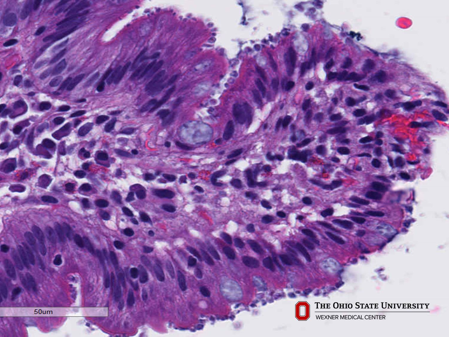 Microscopic image possibly detecting cancerous areas in human tissue