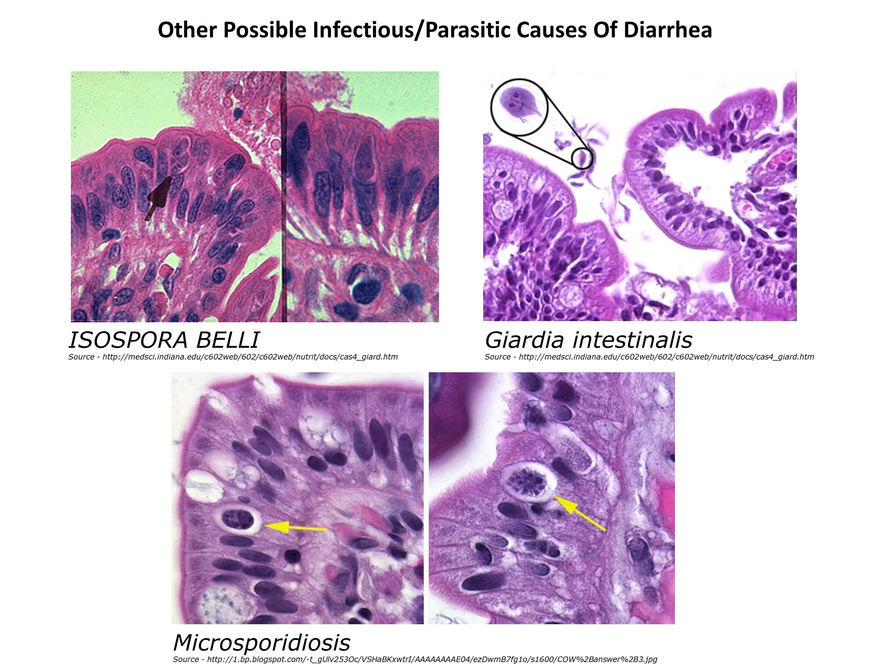 Microscopic image possibly detecting cancerous areas in human tissue