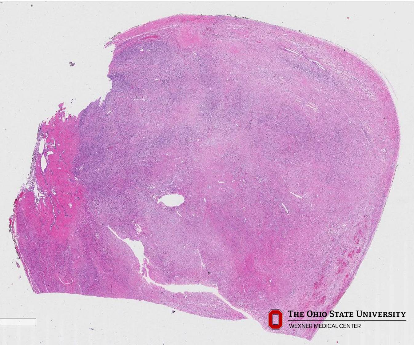 Microscopic image possibly detecting cancerous areas in human tissue