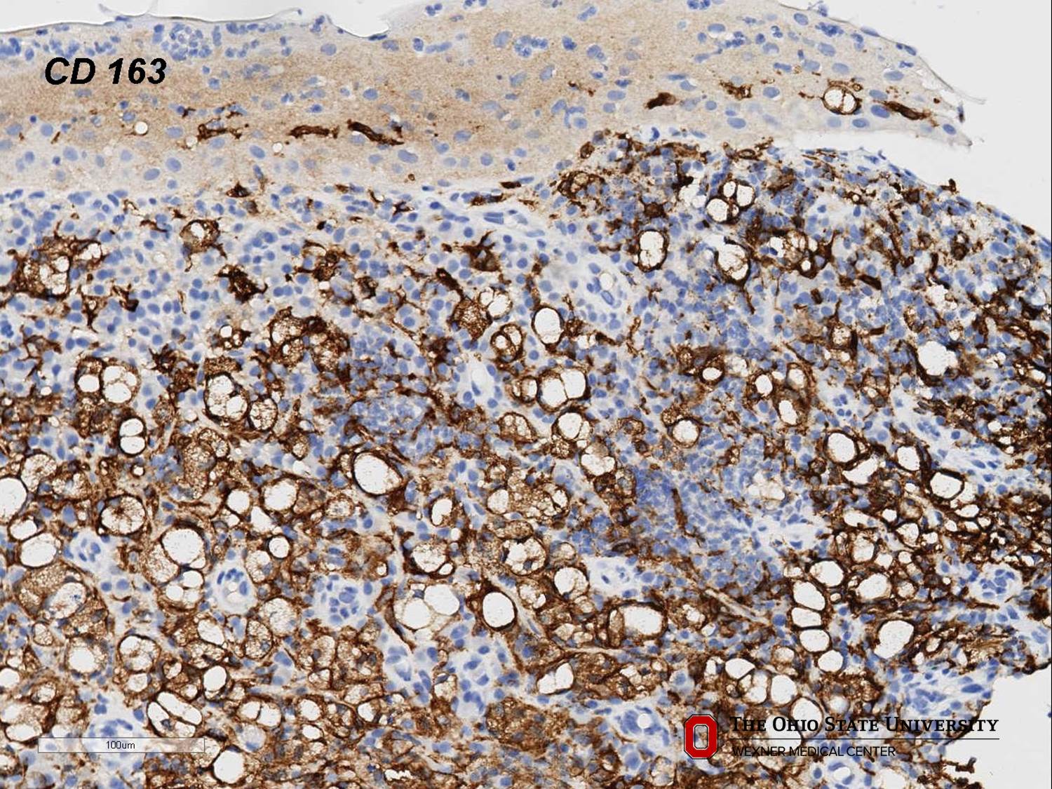 Microscopic image possibly detecting cancerous areas in human tissue