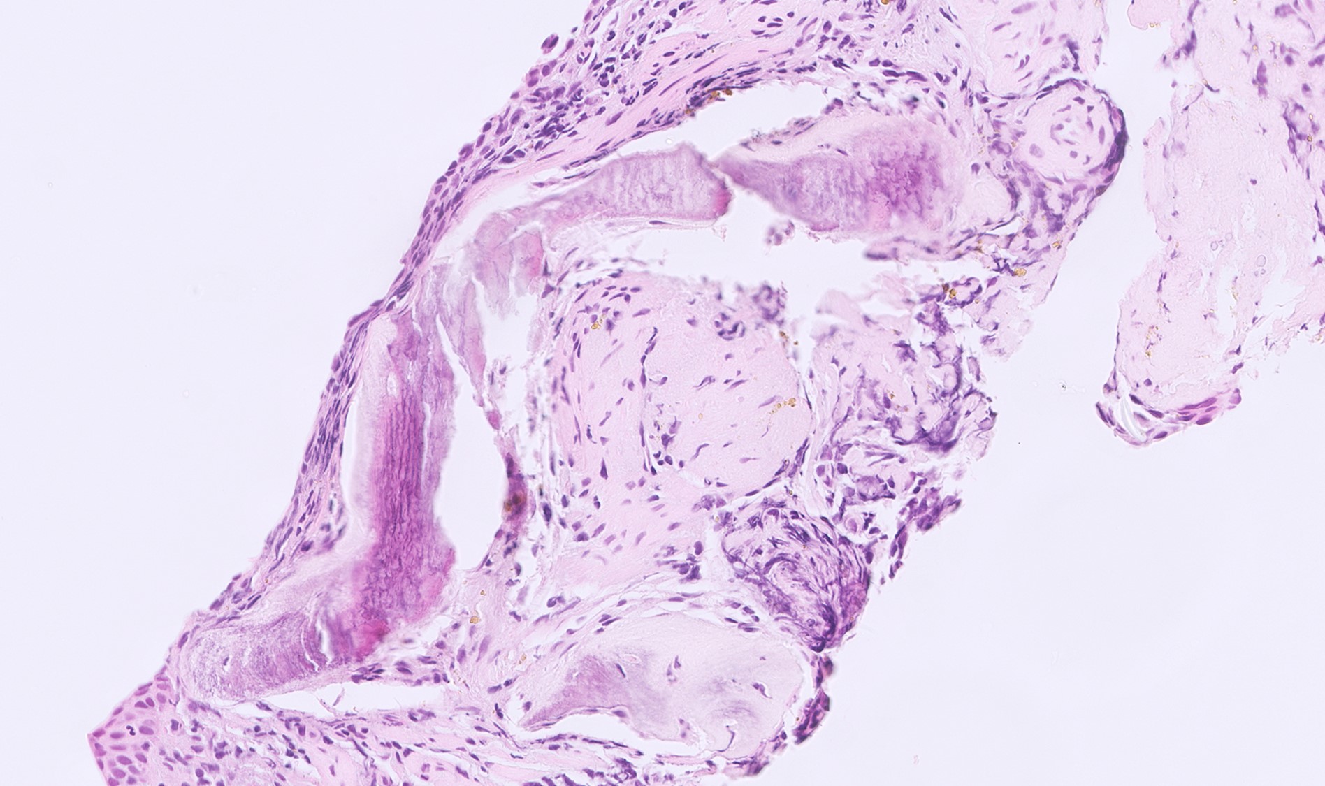 Microscopic image possibly detecting cancerous areas in human tissue