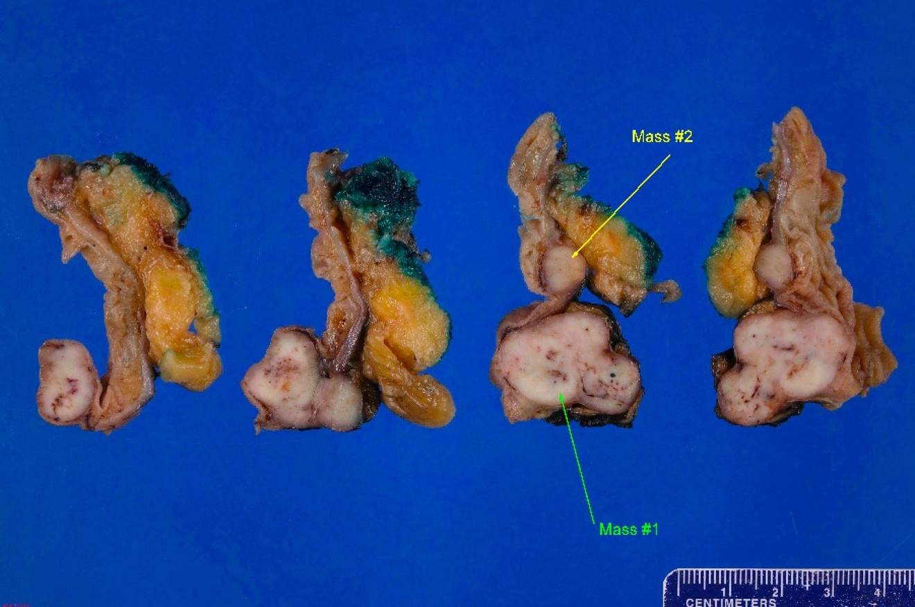 Gross image of small bowel