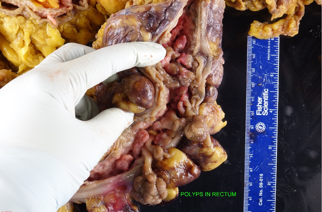 Gross image of small bowel