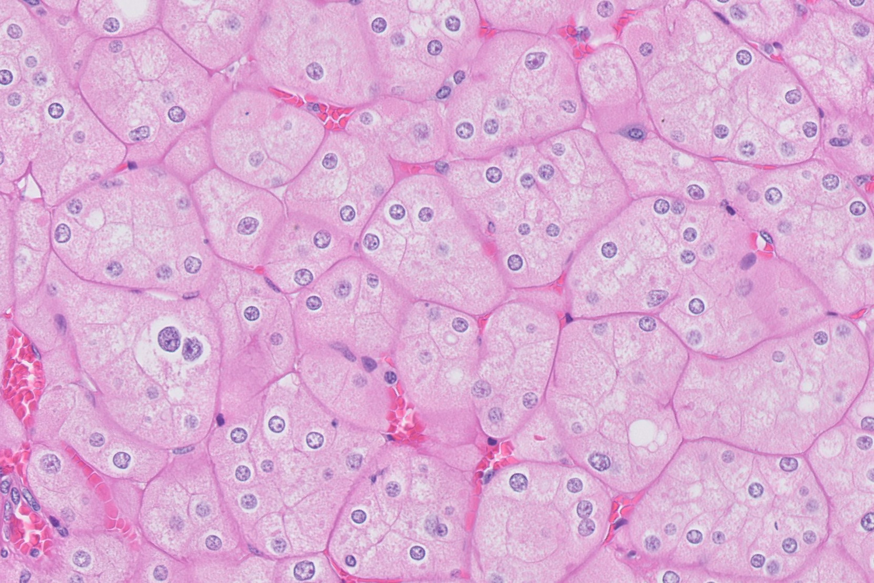 Microscopic image possibly detecting cancerous areas in human tissue