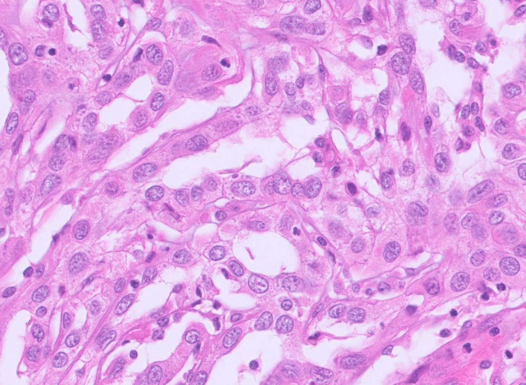 Microscopic image possibly detecting cancerous areas in human tissue