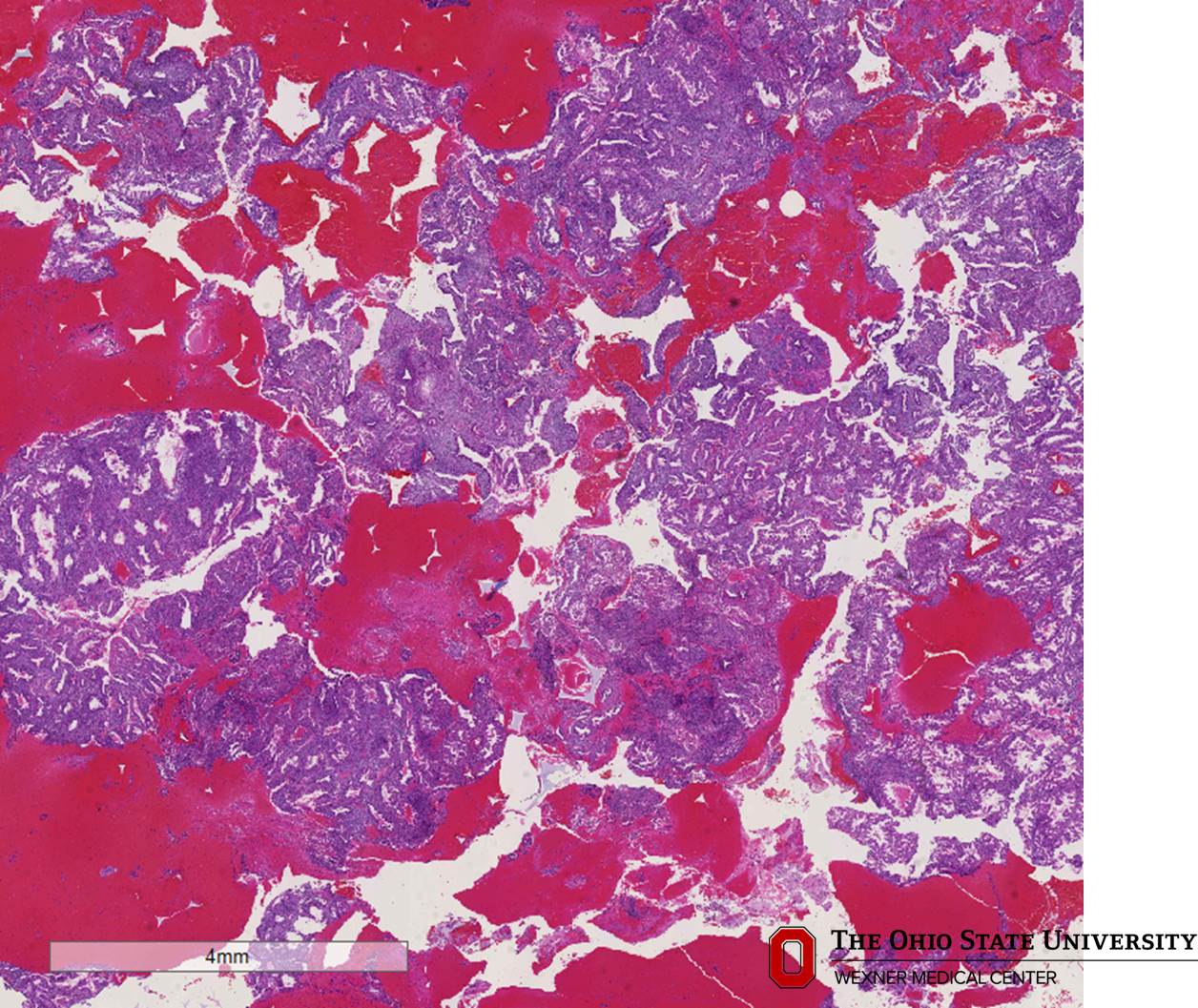 Microscopic image possibly detecting cancerous areas in human tissue