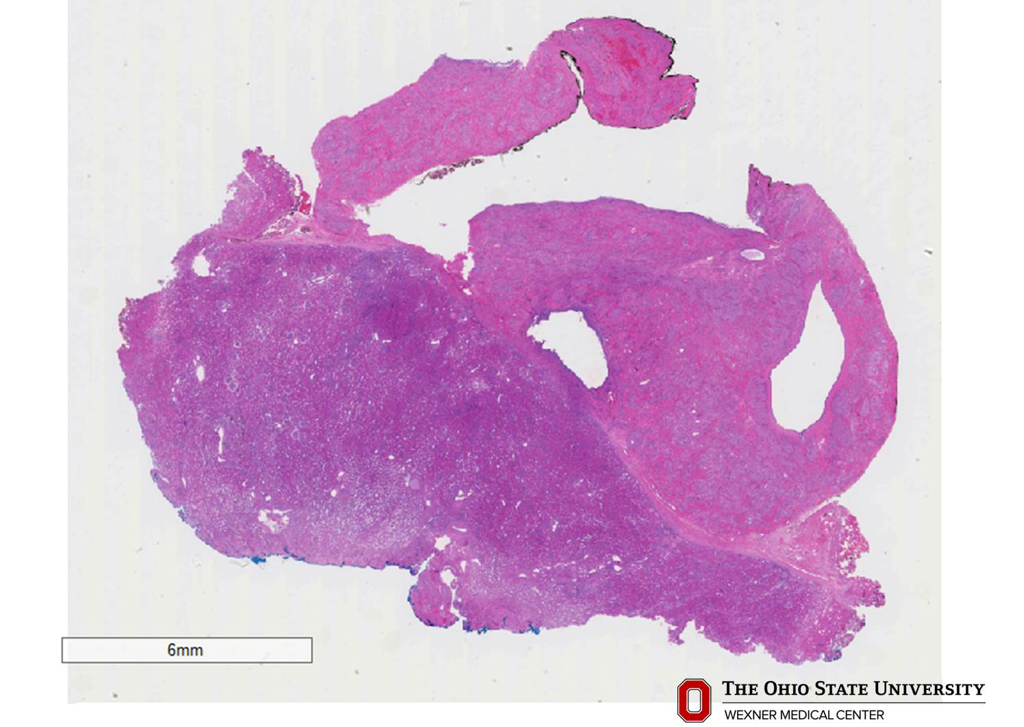 Microscopic image possibly detecting cancerous areas in human tissue