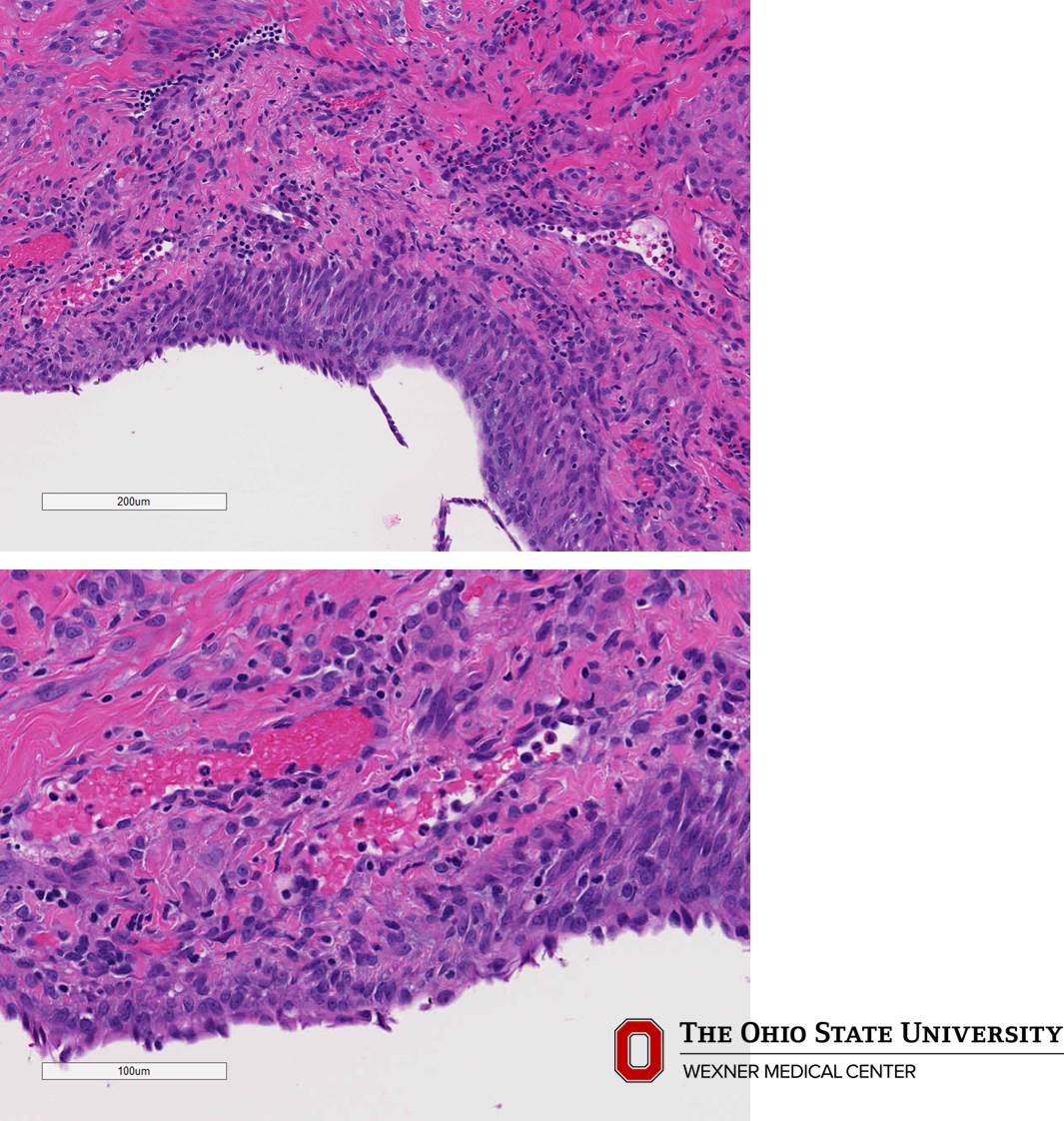 Microscopic image possibly detecting cancerous areas in human tissue