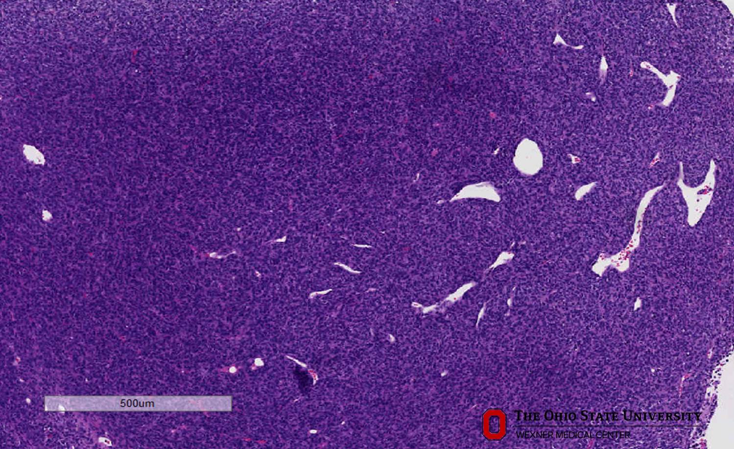 Microscopic image possibly detecting cancerous areas in human tissue