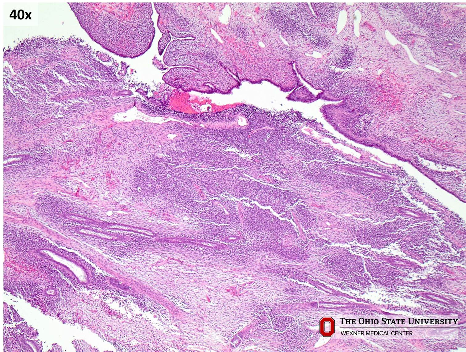 Microscopic image possibly detecting cancerous areas in human tissue