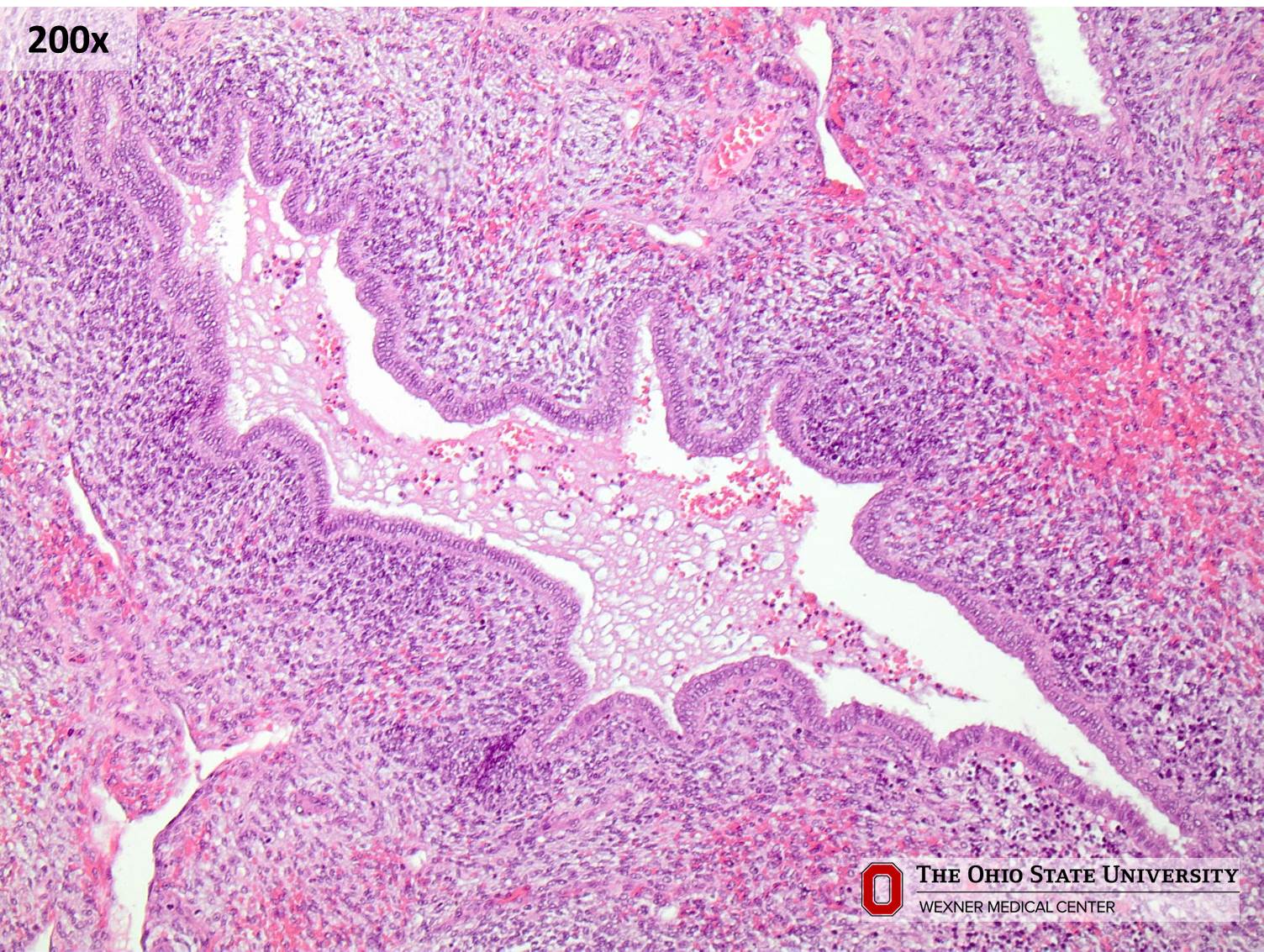 Microscopic image possibly detecting cancerous areas in human tissue