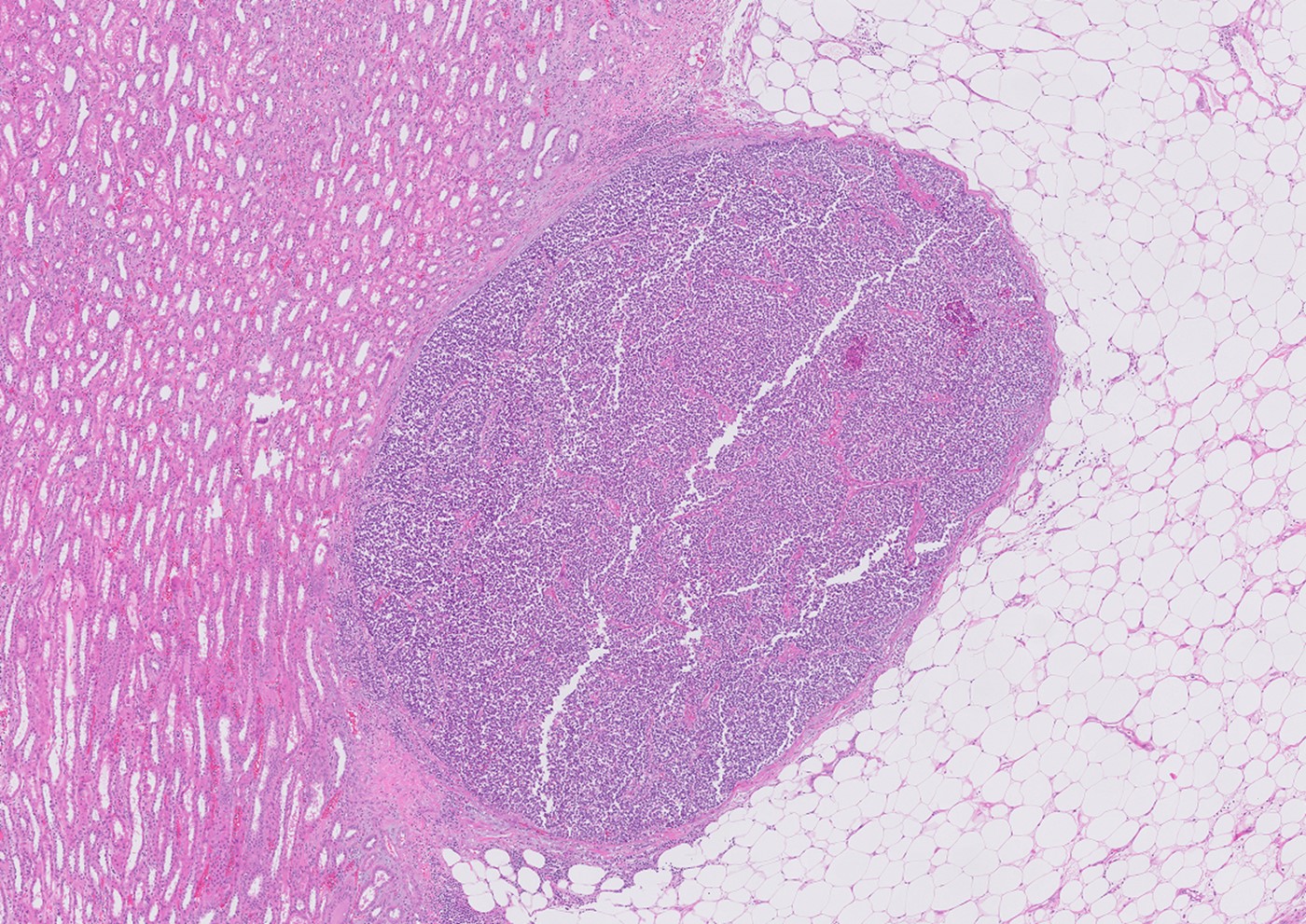 Microscopic image possibly detecting cancerous areas in human tissue