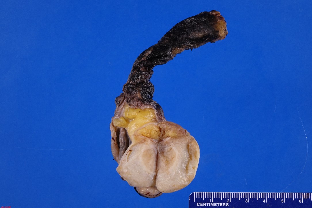 Gross image of testis