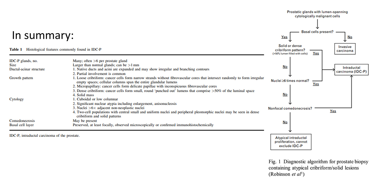 Table describing Intraductal carcinoma findings