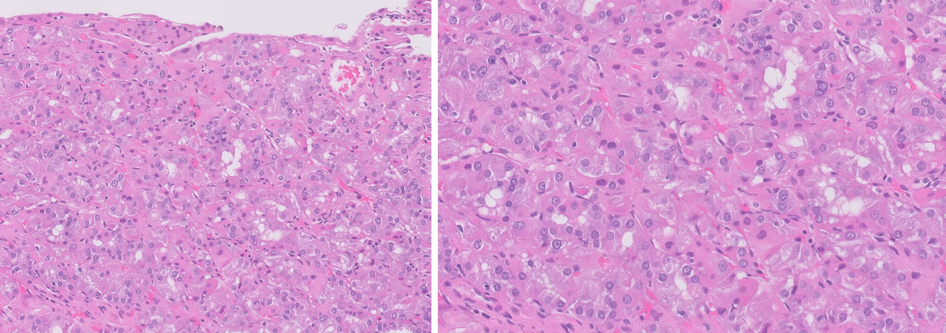 Microscopic image possibly detecting cancerous areas in human tissue