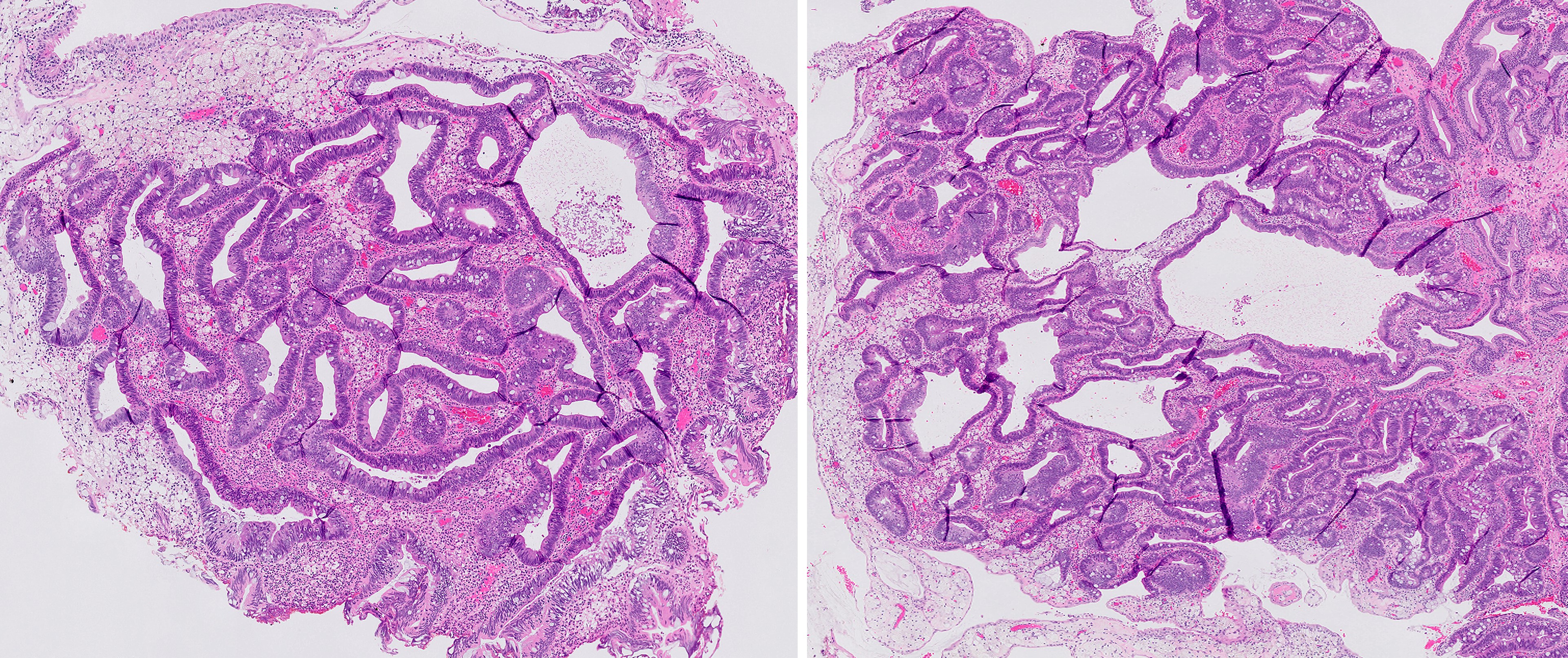 Microscopic image possibly detecting cancerous areas in human tissue