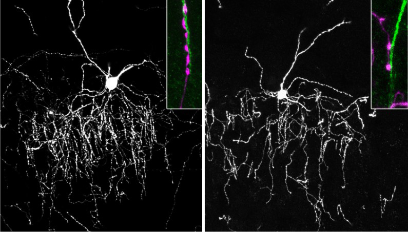 Visualizations of cells in mouse brains