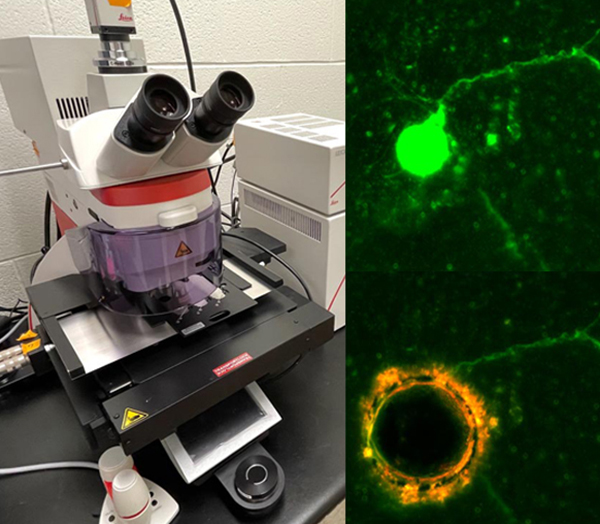 Laser microdissection system with electron microscope imagery