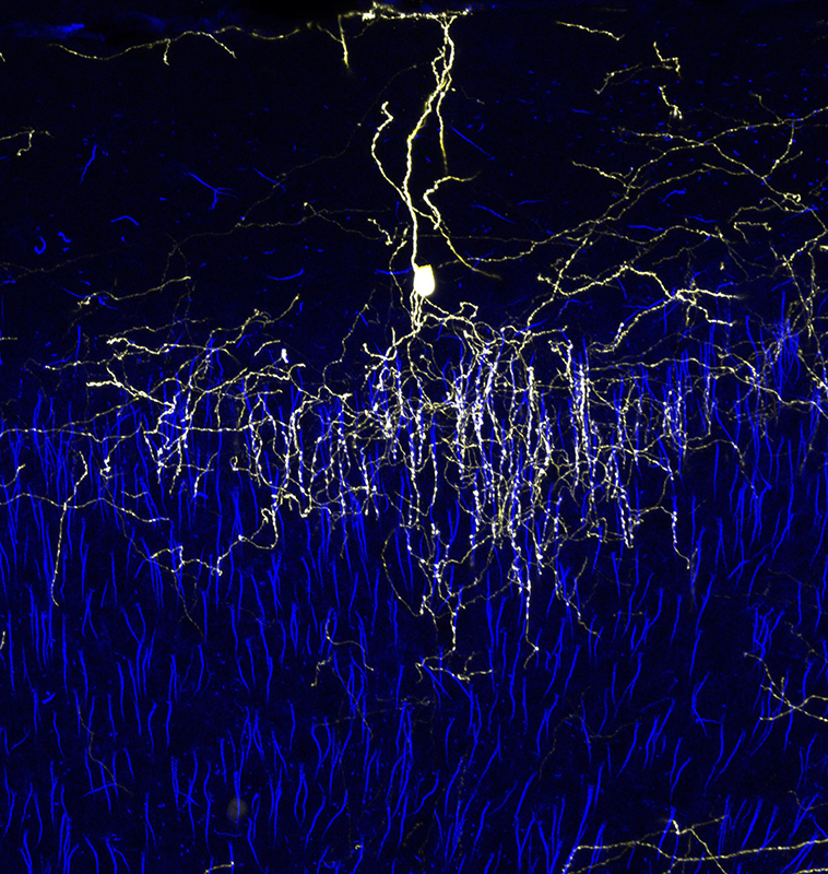 Laboratory research imagery related to cortical interneurons